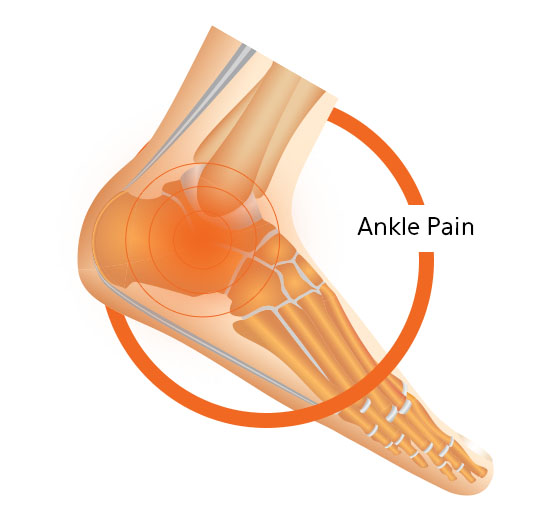 Ankle Pain Foot Diagram Image