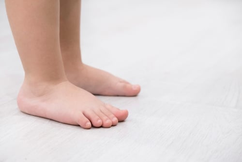 flat feet in children